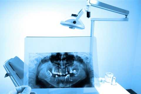 Bexley Dental Educates Community On Full Mouth Dental Implants