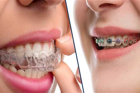 Should i go to a dentist or orthodontist for invisalign?