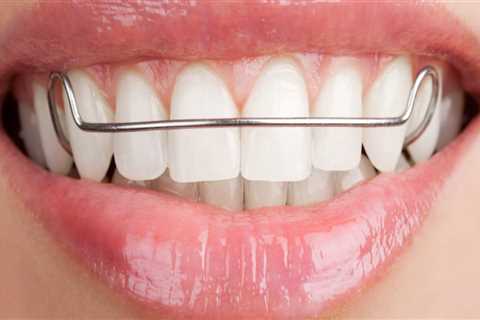 What is considered an orthodontic appliance?