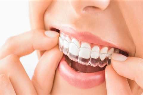 Protecting Your Smile After Invisalign Orthodontics Treatment In San Antonio