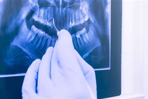 What Supplies Are Used to Take Dental X-Rays?