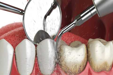 How Often Should Dentists Replace Their Dental Supplies and Tools?
