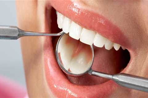 Preserving Natural Teeth: The Primary Goal of Endodontics