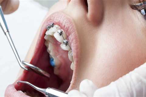 The Significance Of Visiting A Skilled Orthodontist For Orthodontic Treatment In Huntington
