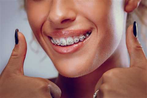 Orthodontics and Self-Esteem: How Straighter Teeth Can Boost Your Confidence