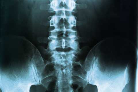 June 22 2023 - GE HealthCare partners with J&J to push spine imaging system
