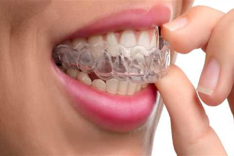 What are the Consequences of Skipping Orthodontic Appointments?