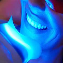 Transform Your Smile: Teeth Whitening In San Antonio