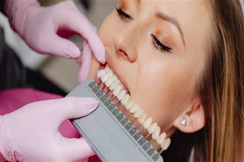 Veneers In Austin: The Perfect Finishing Touch Post-Orthodontics