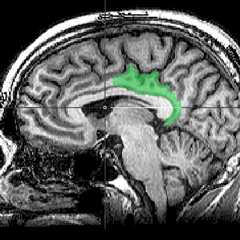 Brain Study Suggests Traumatic Memories Are Processed as Present Experience