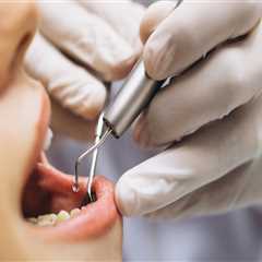 Safeguarding Smiles: The Crucial Role Of Dental Safety In Vancouver