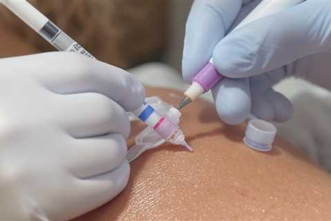 IUD & Implant Placement/Removal in Brownsville, TX