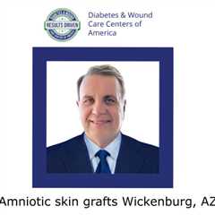 Amniotic skin grafts Wickenburg, AZ