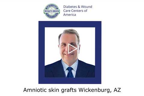 Amniotic skin grafts Wickenburg, AZ - Wickenburg Diabetes and Wound Care Center