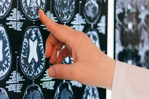 The Cost of a Clear Picture: Why Medical Imaging Can Be So Expensive