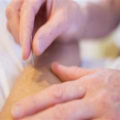 Reduce Stress with Acupuncture for Feet in Portland