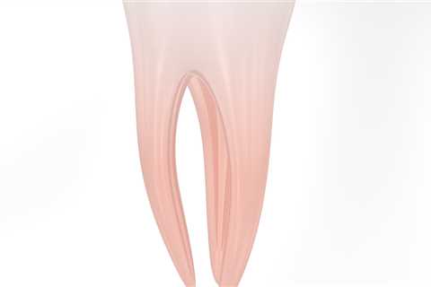 Advanced Solutions for Gum Health and Dental Implants in Kilchberg